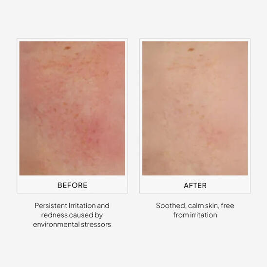 Smoother Skin